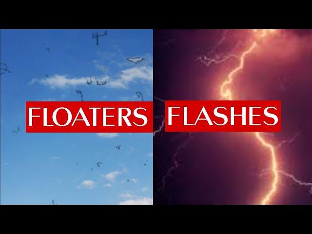 FLOATERS & FLASHES in EYE (photopsias)