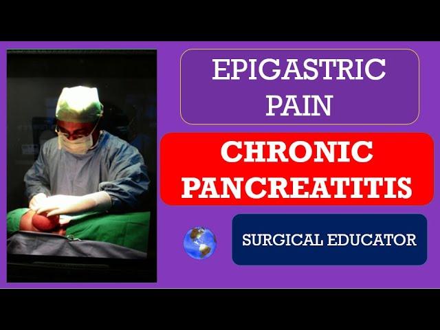 CHRONIC PANCREATITIS- How To DIAGNOSE & TREAT  / EPIGASTRIC PAIN