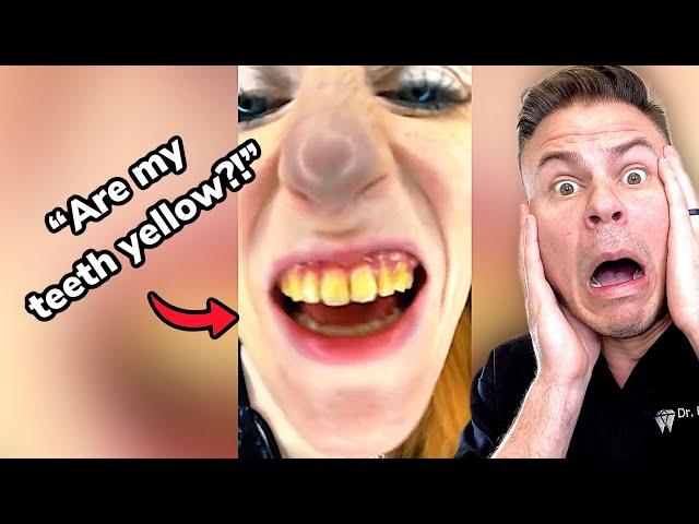 Yellowest Teeth In The World VS Orthodontist