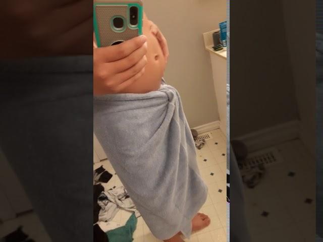 Bloated shower belly