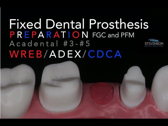 Fixed Dental Prosthesis Preparation - #3-#5 Acadental | WREB-ADEX-CDCA