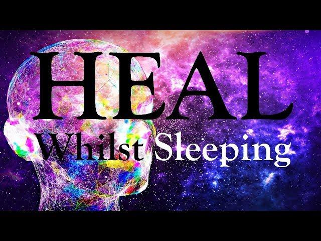 HEAL Your Body Mind, Whilst You Sleep -  POWER of Focused Desire (Guided Meditation)