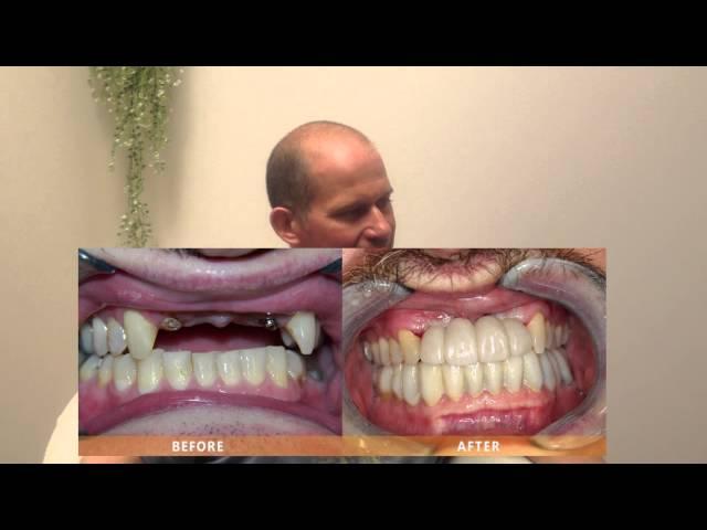 Willie Friesen's Story - Dr. Alex Pavlenko & Sana Dental