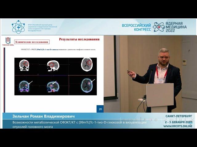 Возможности метаболической ОФЭКТ/КТ с Тиоскан, 99mTc  в визуализации опухолей головного мозга