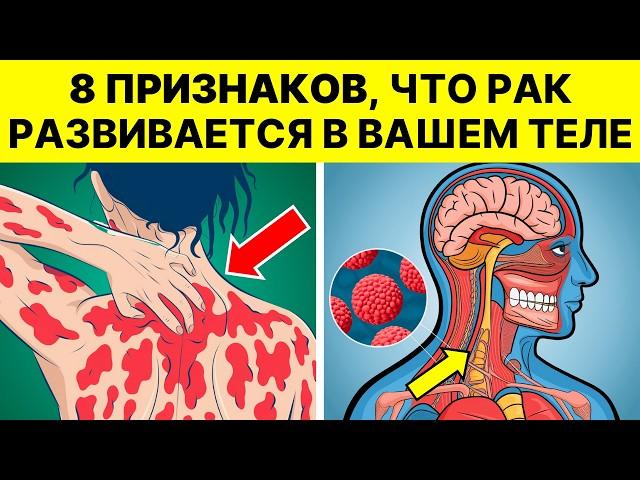 НЕ ПРОПУСТИТЕ ЭТИ 8 ПЕРВЫХ ПРИЗНАКОВ РАКА – ЭТО МОЖЕТ СПАСТИ ВАШУ ЖИЗНЬ!