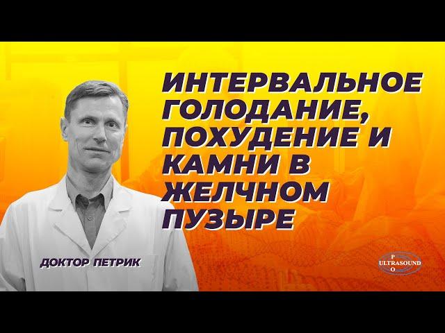 Интервальное голодание, похудение и камни в желчном пузыре.