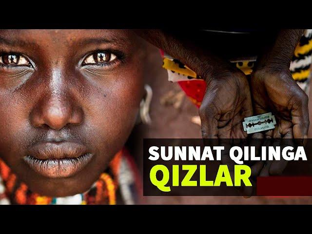 Sunnat qilingan qizlar: Buni ko'rib qo'rquv bosadi kishini