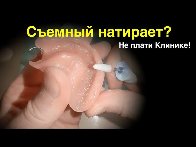 Как САМОМУ подточить Съёмный Протез?! #безнёбасъёмныепротезы #зубныепротезы #съёмныепротезы