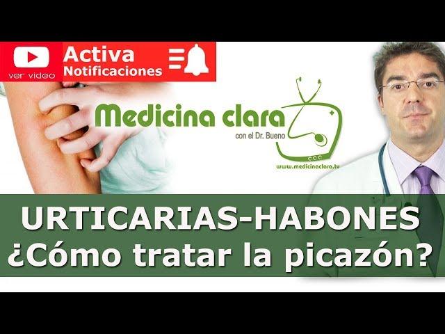 Urticaria | Habons and hives | How to avoid and treat an itch