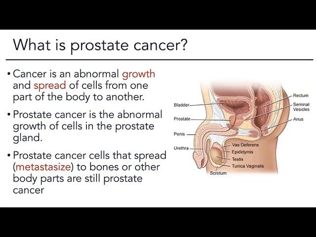 Prostate Cancer Overview