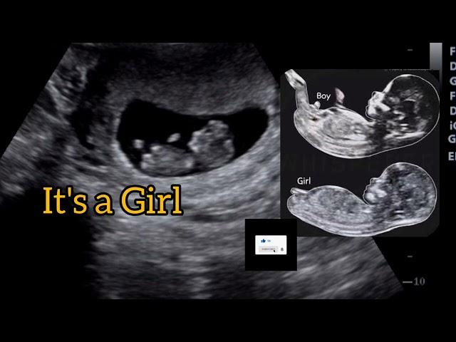 it's a baby girl by 'Nub Theory' !! Ultrasound