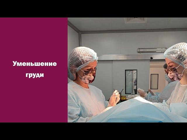 Результат уменьшения груди - редукционная маммопластика