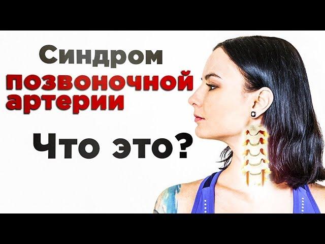 Как вылечить синдром позвоночной артерии?