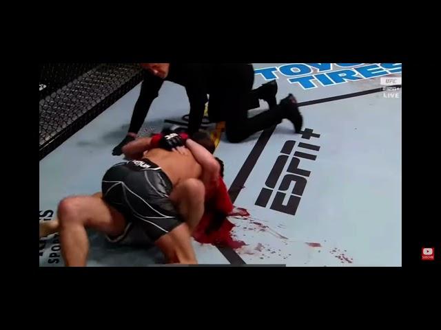 Charles Rosa vs Damon Jackson(Bloodiest fight in the ufc?)