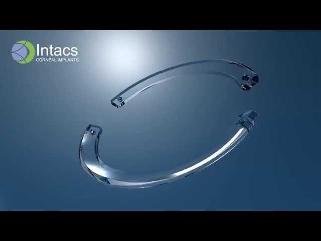 INTACS Corneal Implants