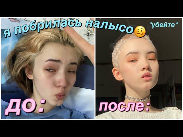 Я Побрилась Налысо (волосы ТОЧНО ПОКИНУЛИ ЧАТ)