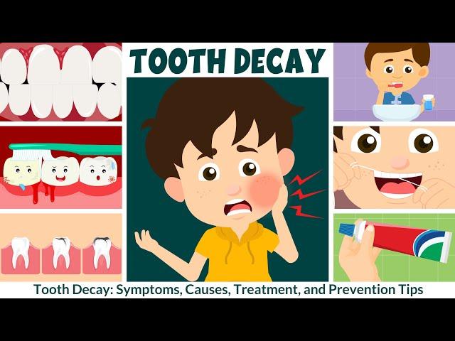 Tooth Decay: Symptoms, Causes, Treatment, and Prevention | Video for Kids | Learning Junction