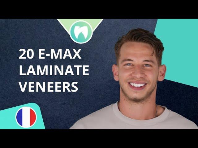 E-max Laminate Veneers in Turkey | Amazing Smile Transformation at Dentatur