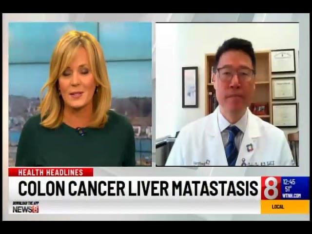 Colon Cancer Liver Metastasis