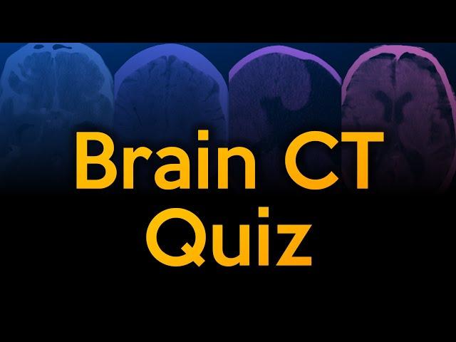 Brain CT Quiz Challenge