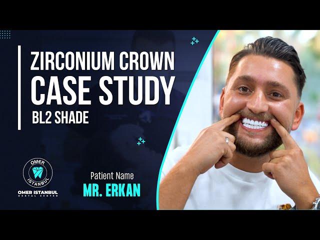 Zirconia Crown Case Study (BL2 Shade) - Narrated by Dr. Omer Karaaslan