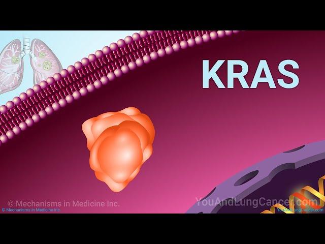 Understanding NSCLC Treatment When You Have a KRAS Mutation