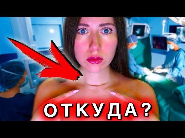 МОЙ ШРАМ НА ШЕЕ  | Elli Di