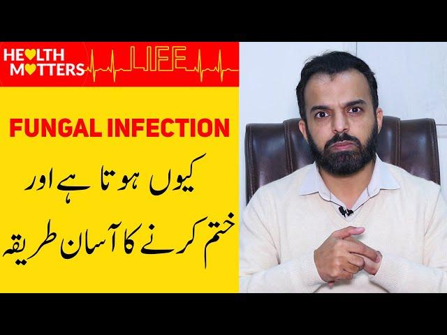 Fungal Infection Treatment - Fungal Infection of Skin In Urdu/Hindi - Fungus Ka Ilaj