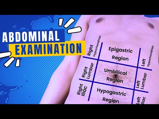 Abdominal Examination | Aspire PLAB/UKMLA Academy