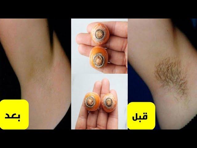 حبة جبارة/أقوى من الليزر/لإزالة شعر العانة والجسم كله نهائيا بلا عودة في5 دقائق وتبييض البشرة 4درجات