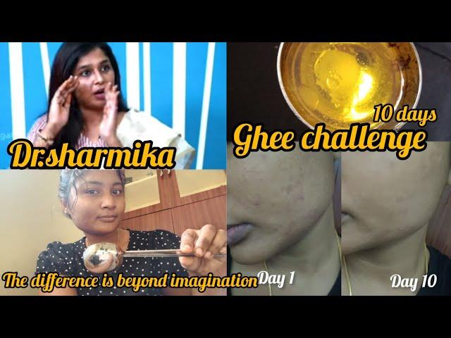 நினைச்சுக் கூட பார்க்க முடியாத அளவுக்கு ஒரு வித்தியாசம் ghee challenge dr.sharmika#drsharmika #ghee