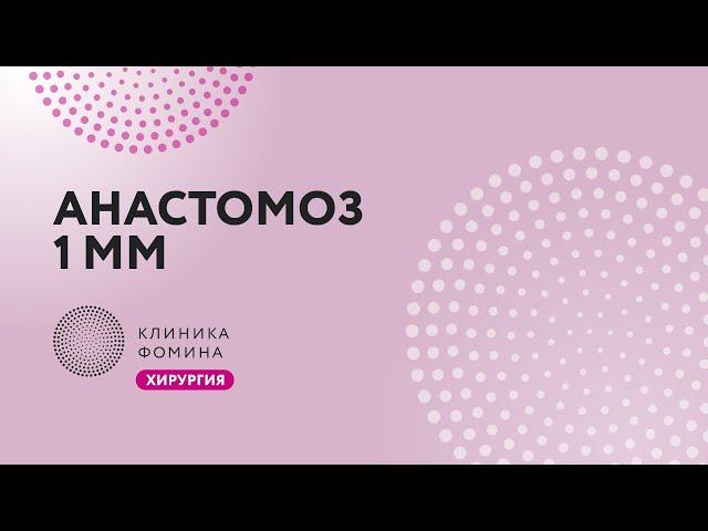 анастомоз маточной трубы // реканализация маточных труб // восстановление фертильности