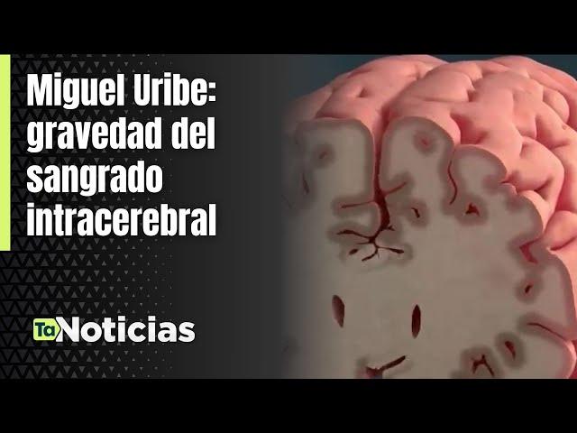 Miguel Uribe: gravedad del sangrado intracerebral - Teleantioquia Noticias