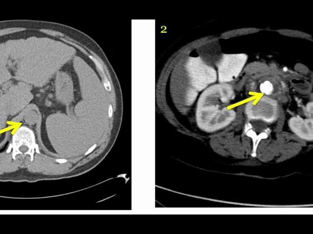 Introduction to Radiology: Computed Tomography