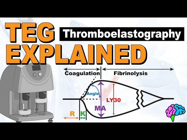 TEG Explained - Understanding the Thromboelastography