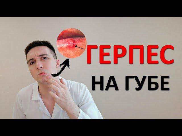 Герпес (простуда) на губе. Как быстро вылечить? Чем мазать?