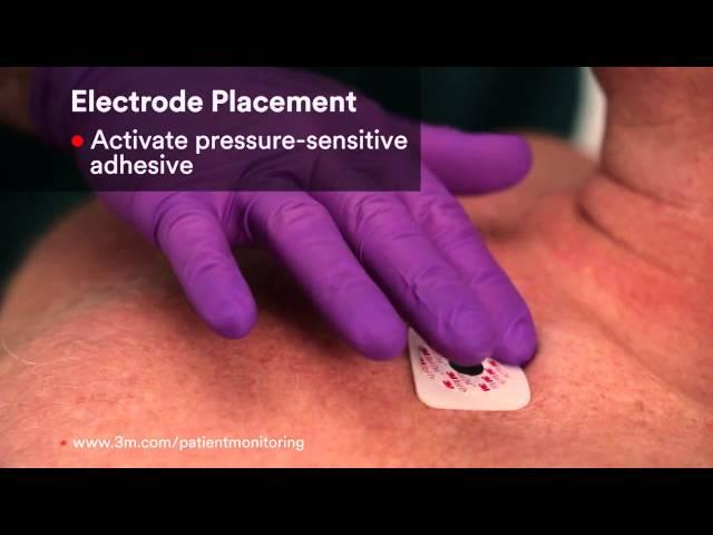 Red Dot Electrodes Application Video