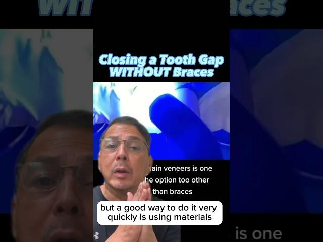 Closing a Front Tooth Gap WITHOUT Braces |  In Office to Hands On Dental Training