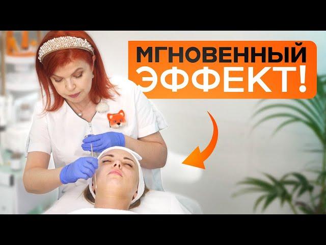 НЕ ДЕЛАЙ химический ПИЛИНГ лица, пока не ПОСМОТРИШЬ ЭТО видео!