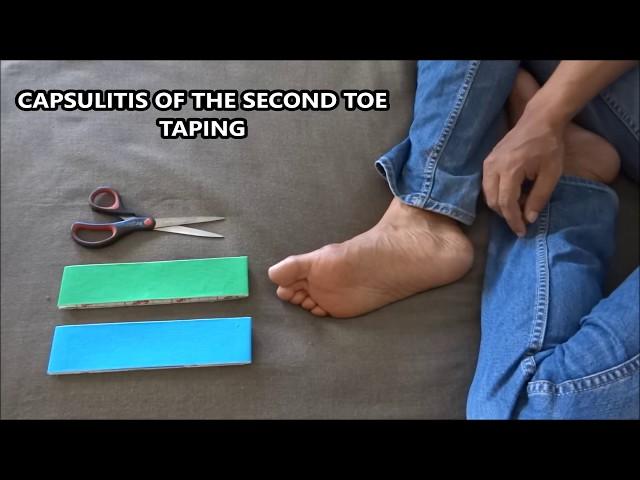 Capsulitis of the second toe taping