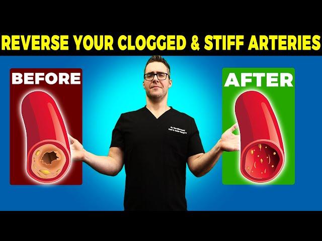 REVERSE Your Clogged & Stiff Arteries [50% Atherosclerosis over 45!]