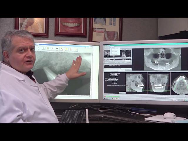 What is the Benefit of a Dental Cone Beam CT Scan | Dr. Parsa Zadeh