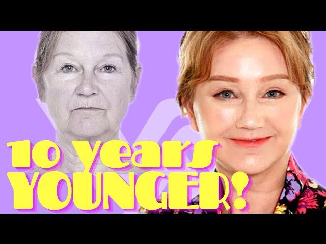 10 YEARS YOUNGER! Anti-Aging surgery in Korea | Docfinderkorea X Kat Wonders