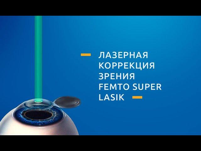 Фемто Супер ЛАСИК (Femto Super LASIK)  - операция лазерной коррекции зрения