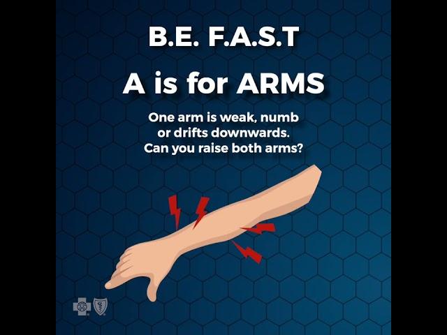 Stroke Symptoms & Warning Signs B.E. F.A.S.T. | #shorts