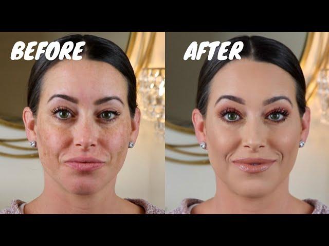 FULL COVERAGE MAKEUP FOR MELASMA & HYPERPIGMENTATION (pregnant foundation routine)