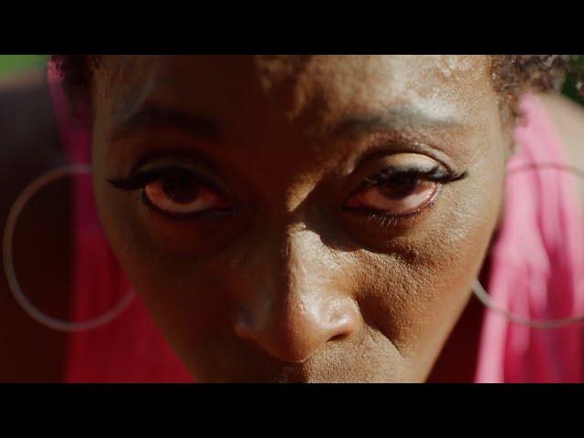 Olympic Gold Medalist Gail Devers on Thyroid Eye Disease