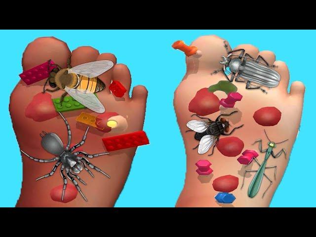 Foot Clinic - Gameplay Walkthrough - All Levels (IOS, Android)