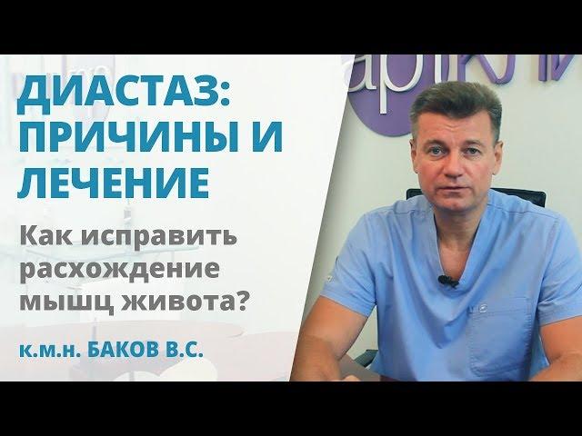 Диастаз – расхождение прямых мышц живота. Причины и способы лечения