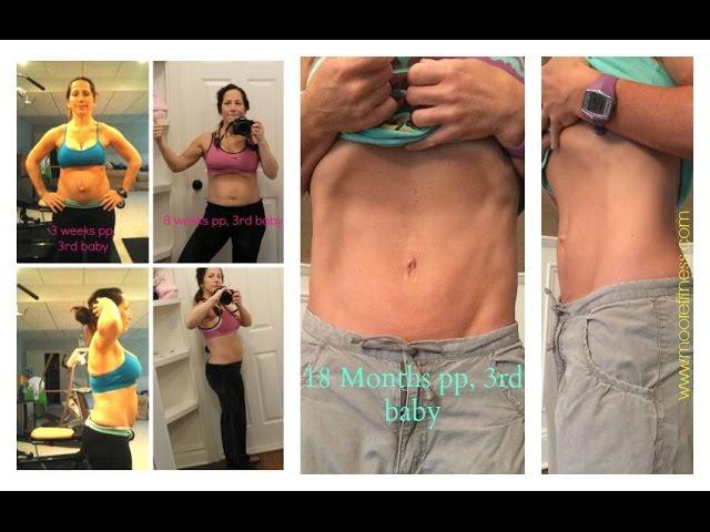 Your Guide to Treating Diastasis Recti (Part 2)